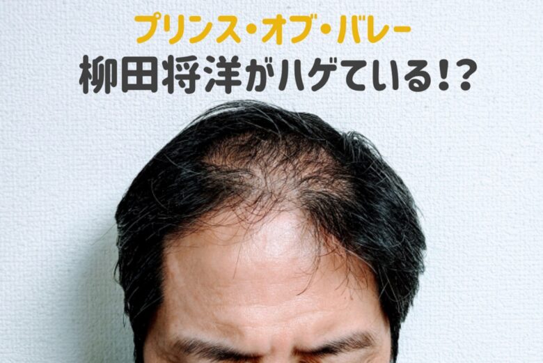 柳田将洋の髪の毛